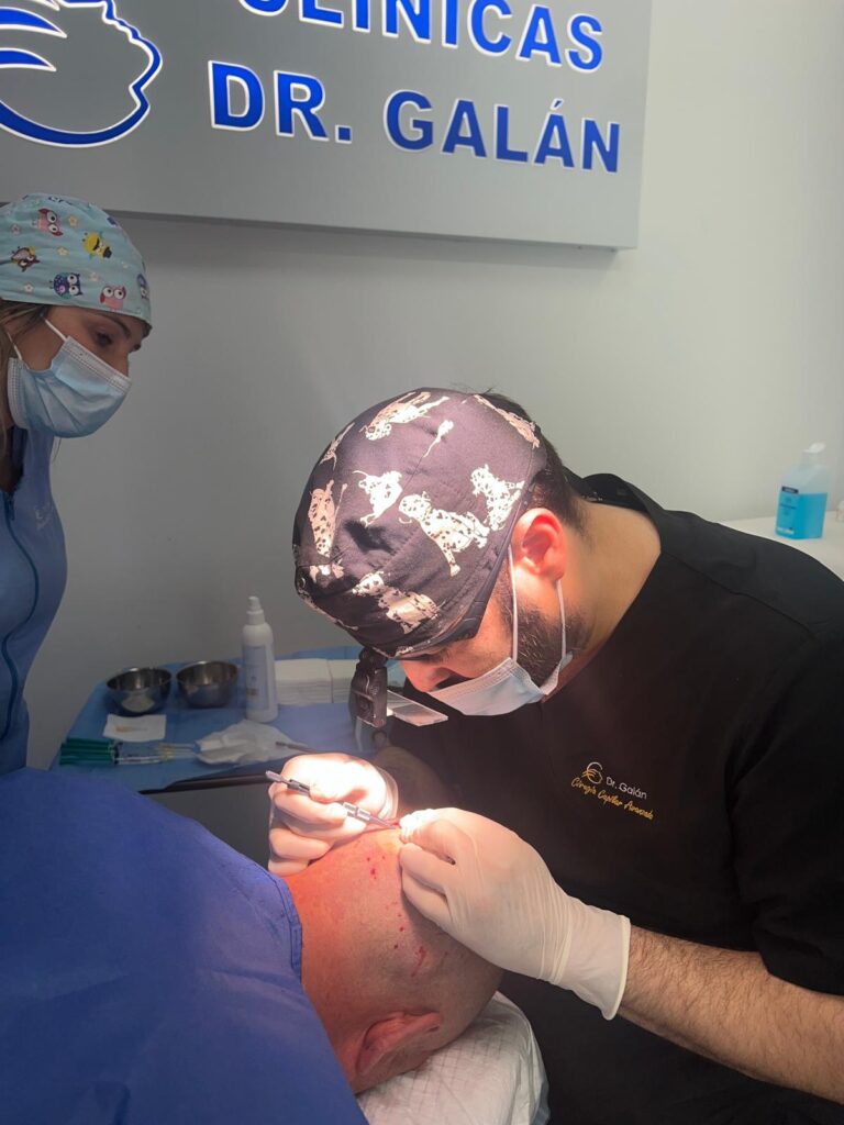transplante-capilar-Celebrity-FUE-doctor-galan-768x1024